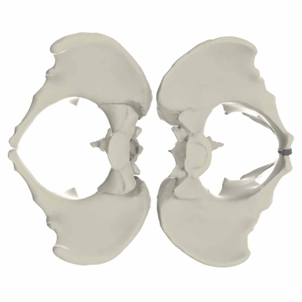 Models of male and female pelves contrasted with each other